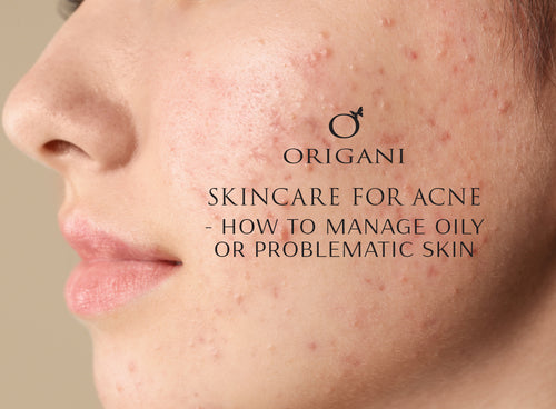 Skincare For Acne - How To Manage Oily Or Problematic Skin
